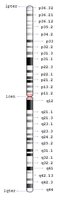 Ideogram of human chromosome with G-banding patterns and labeled regions