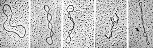 Electron micrographs of DNA in different topological states