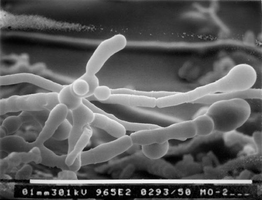 Neurospora crassa under microscope