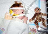 Infant with SMA