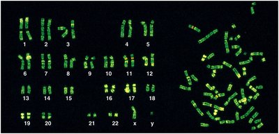Karyotype showing human chromosomes including X and Y