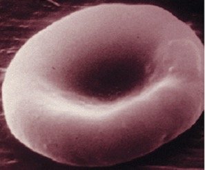 Normal red blood cell