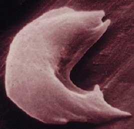 Sickle-shaped red blood cell