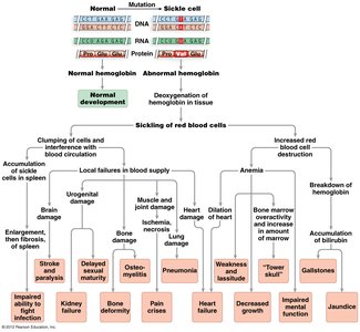 Diagram of sickle cell disease pathophysiology and pleiotropic effects