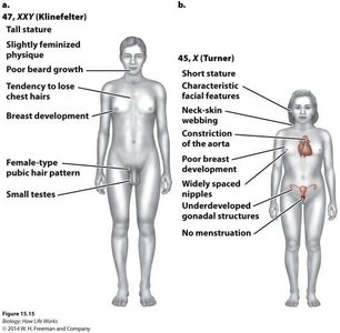 Klinefelter and Turner syndrome phenotypes