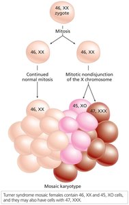 Mosaicism in Turner syndrome