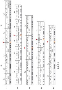 Standardized human chromosome banding patterns