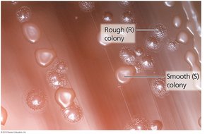 Rough and smooth bacterial colonies