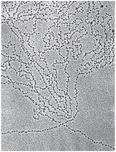 Electron micrograph of nucleosomes as beads on a string