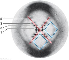 X-ray diffraction pattern of DNA