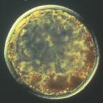 Stem cell potency: totipotent, pluripotent, multipotent, unipotent