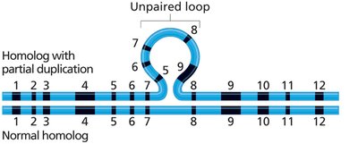 Unpaired loop at synapsis due to duplication or deletion