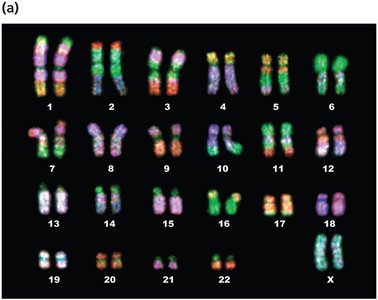 FISH karyotype with fluorescent probes