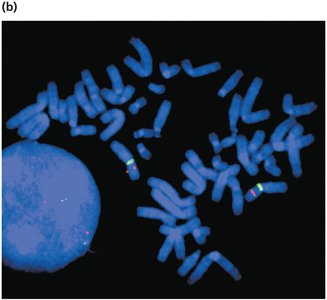 FISH image showing fluorescently labeled chromosomes