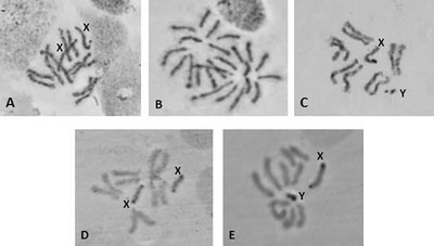 Karyotype images showing X and Y chromosomes
