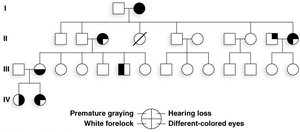 Pedigree showing variable expressivity of Waardenburg syndrome
