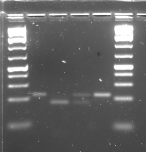 Agarose gel with DNA bands