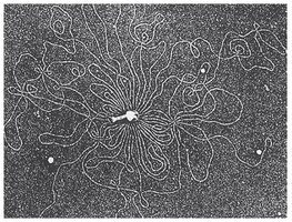 Electron micrograph of a bacterial nucleoid