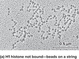 Beads-on-a-string chromatin structure