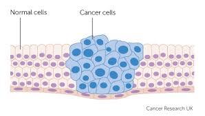 Diagram showing normal cells and cancer cells