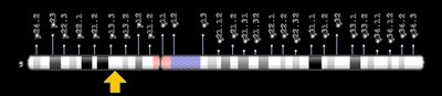 GALT gene location on chromosome 9