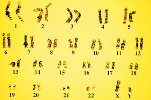 Human karyotype showing homologous chromosomes