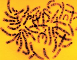 Chromosome banding pattern