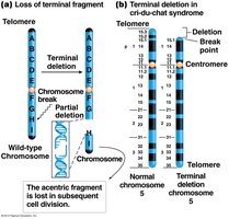 Diagram of terminal deletion and Cri-du-chat syndrome