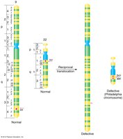Diagram of Philadelphia chromosome translocation