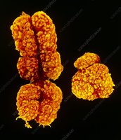 Human X and Y chromosomes, showing their heteromorphic nature