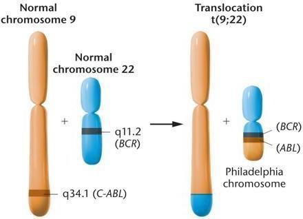 Philadelphia chromosome formation by t(9;22) translocation