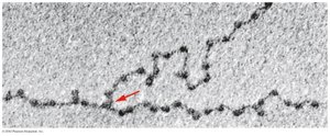 Electron micrograph of chromatin showing beads on a string structure