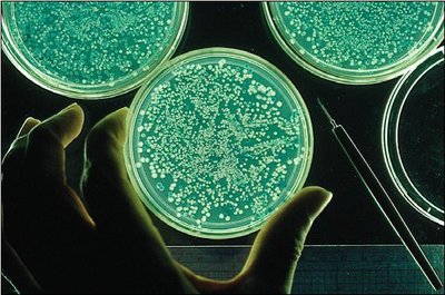 Bacterial colonies on selection plate