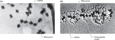 Electron micrograph of polyribosomes showing mRNA and ribosomes