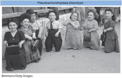 Individuals with pseudoachondroplasia, an autosomal dominant trait