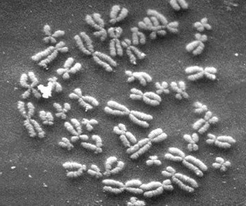 Human chromosomes under electron microscope