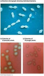 S and R strains of Streptococcus pneumoniae