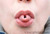 Tongue rolling