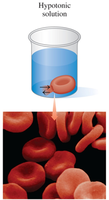Red blood cells in hypotonic solution (hemolysis)