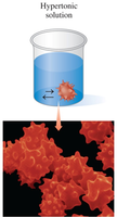 Red blood cells in hypertonic solution (crenation)