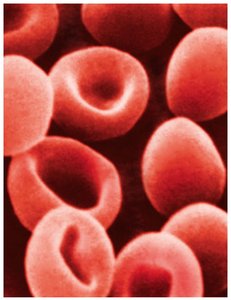Red blood cells in isotonic, hypotonic, and hypertonic solutions