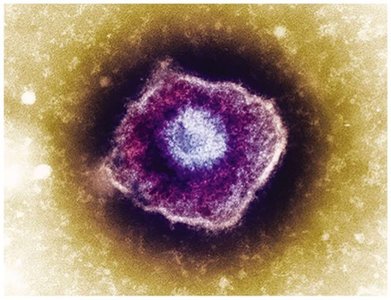 Microscopic image of a chickenpox virus