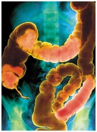 BaSO4 in X-ray imaging