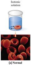 Isotonic solution and normal red blood cells