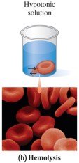 Hemolysis in hypotonic solution