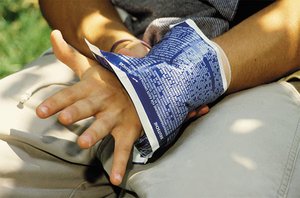 A cold pack applied to a wrist, illustrating an endothermic reaction