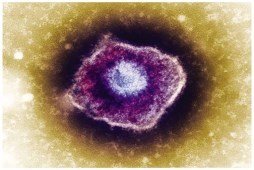Microscopic image of a virus, diameter in scientific notation
