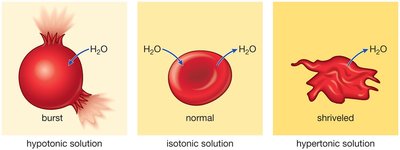 Red blood cells in hypotonic, isotonic, and hypertonic solutions