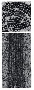 Electron micrograph of sickle cell hemoglobin aggregates