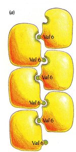 Schematic of sickle cell hemoglobin aggregation